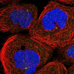 ANKAR Antibody, Novus Biologicals 0.1mL; Unlabeled:Antibodies, Polyclonal